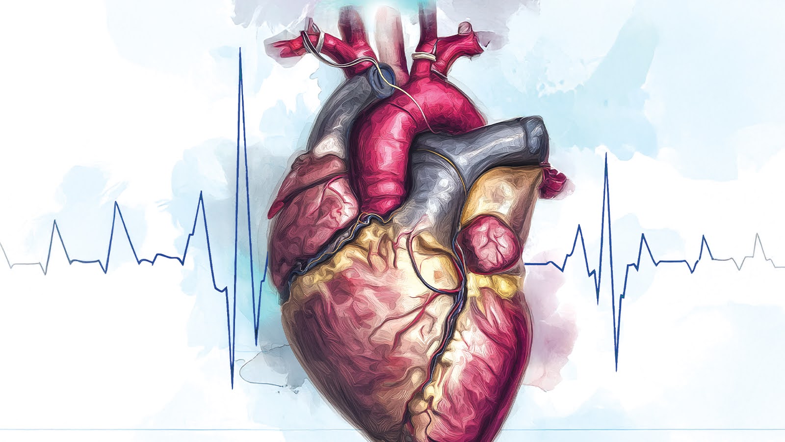 diagnostic-electrophysiology-catheters-stylized-heart-graphic